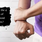 what are the 4 stages of rheumatoid arthritis